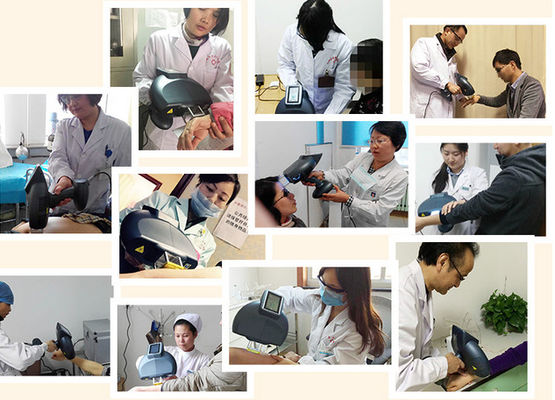 High Dose 308NM Excimer System Xecl Laser 18s Erythema Home Use